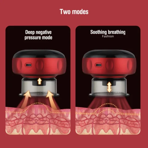 Intelligent Vacuum Cupping Massage Device Electric Heating Scraping Suction Cups Physical Fatigue Relieve Health Guasha Cans - AliExpress 66 - Image 3